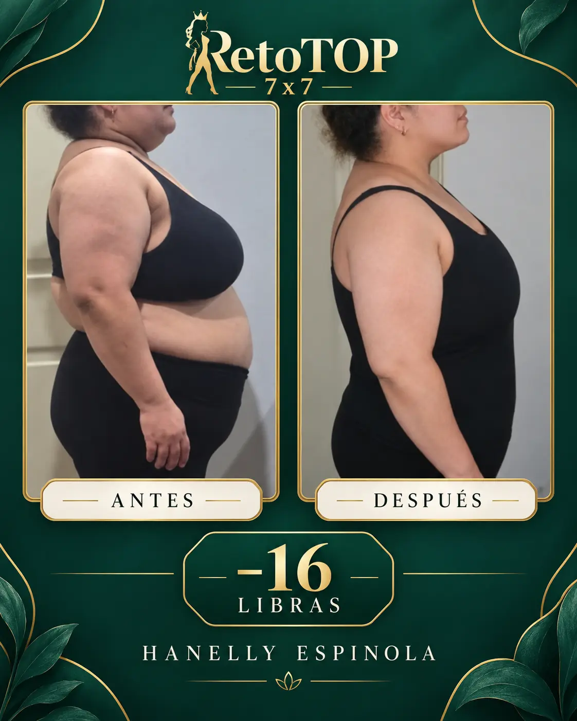 Comparación documentada de Hanelly Espinola: antes y después, con 16 libras reportadas